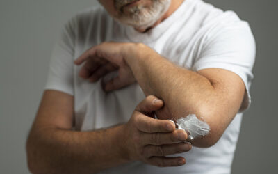 ¿Picaduras de mosquitos o medusas? Alivia el picor al instante